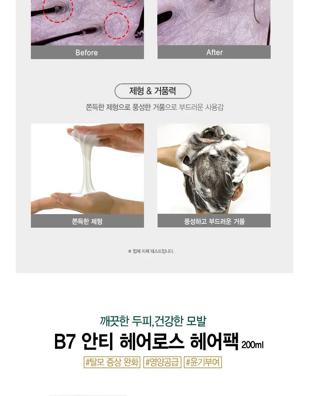 [광고비_안태운_품질] 포레스트스토리 B7 안티 헤어 로스 샴푸 200ml 상세페이지 12